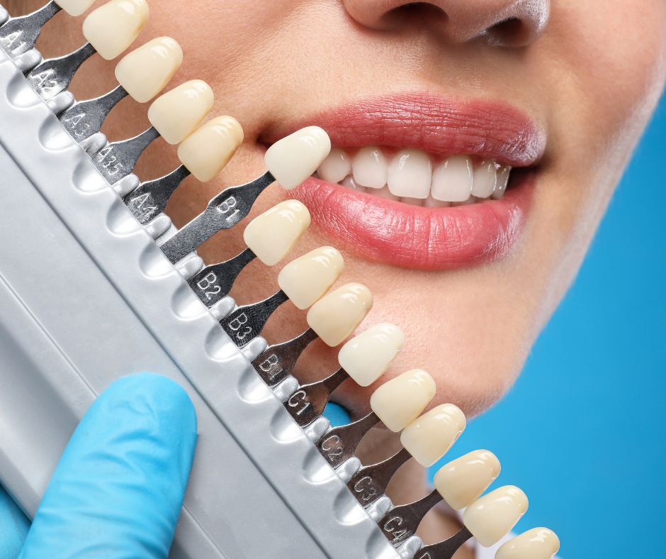 Affordable Cosmetic Dentistry Options for a Beautiful Smile